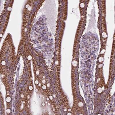 Immunohistochemistry: PYCRL Antibody [NBP2-49611]