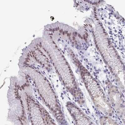 Immunohistochemistry-Paraffin: PYCRL Antibody [NBP2-49396]