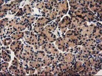 Immunohistochemistry: PYCRL Antibody (OTI1B12) - Azide and BSA Free [NBP2-73752]