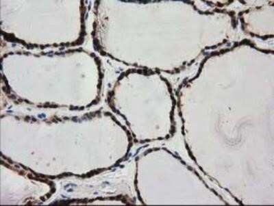 Immunohistochemistry: PYCRL Antibody (OTI1B12) - Azide and BSA Free [NBP2-73752]
