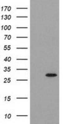 Western Blot: PYCRL Antibody (OTI1B12) [NBP2-03337]