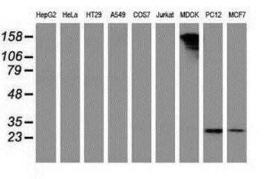 Western Blot: PYCRL Antibody (OTI1B12) [NBP2-03337]