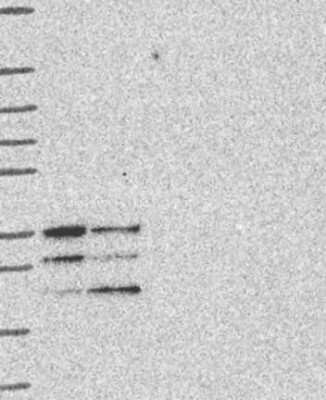 Western Blot: PYCRL Antibody [NBP3-17918]