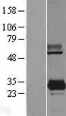 Western Blot: PYCRL Overexpression Lysate [NBL1-15019]