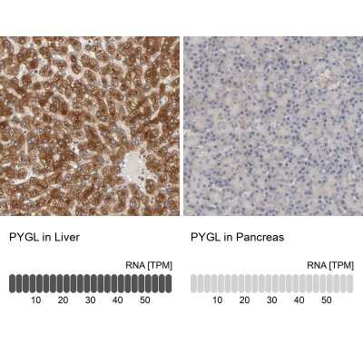Immunohistochemistry-Paraffin: PYGL Antibody [NBP1-86147]