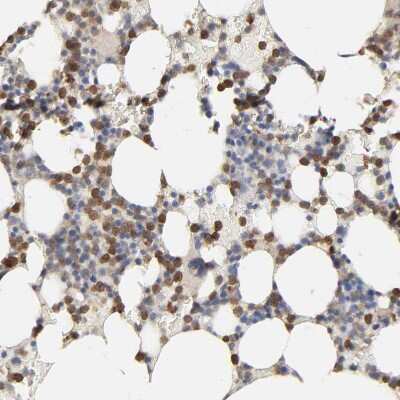Immunohistochemistry-Paraffin: PYGL Antibody [NBP1-86147]