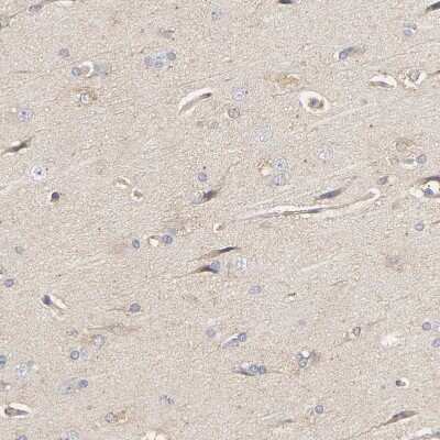 Immunohistochemistry-Paraffin: PYGL Antibody [NBP1-86147]