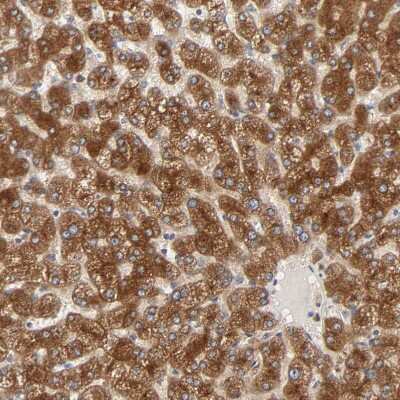 Immunohistochemistry-Paraffin: PYGL Antibody [NBP1-86147]