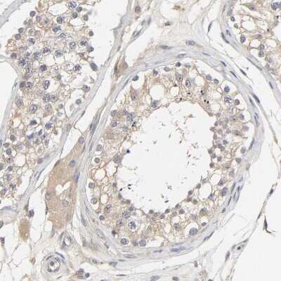 Immunohistochemistry-Paraffin: PYGL Antibody [NBP1-86147]