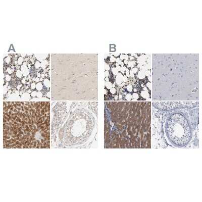 Immunohistochemistry-Paraffin: PYGL Antibody [NBP1-86147]