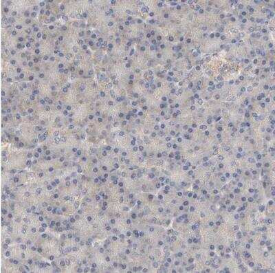 Immunohistochemistry-Paraffin: PYGL Antibody [NBP1-86147]