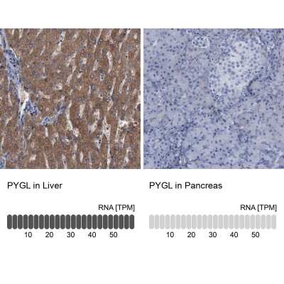 Immunohistochemistry-Paraffin: PYGL Antibody [NBP1-86182]