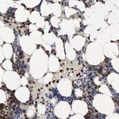 Immunohistochemistry-Paraffin: PYGL Antibody [NBP1-86182]