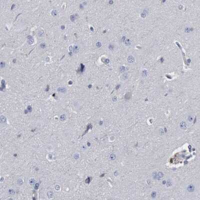 Immunohistochemistry-Paraffin: PYGL Antibody [NBP1-86182]