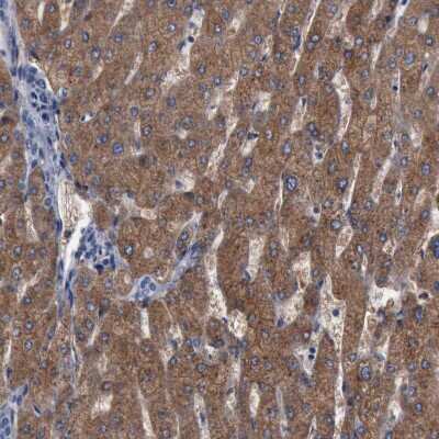 Immunohistochemistry-Paraffin: PYGL Antibody [NBP1-86182]