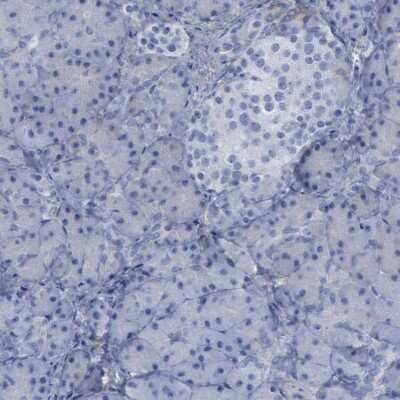 Immunohistochemistry-Paraffin: PYGL Antibody [NBP1-86182]