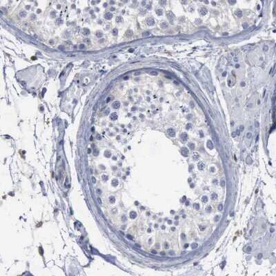 Immunohistochemistry-Paraffin: PYGL Antibody [NBP1-86182]