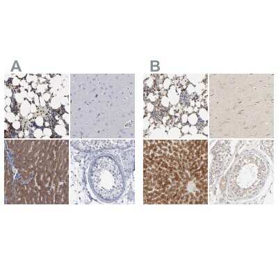 Immunohistochemistry-Paraffin: PYGL Antibody [NBP1-86182]