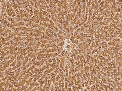 Immunohistochemistry-Paraffin: PYGL Antibody [NBP2-97708]