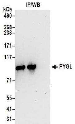 Immunoprecipitation: PYGL Antibody [NBP2-32246]