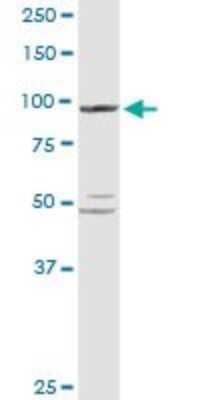 Western Blot: PYGL Antibody [H00005836-D01P]