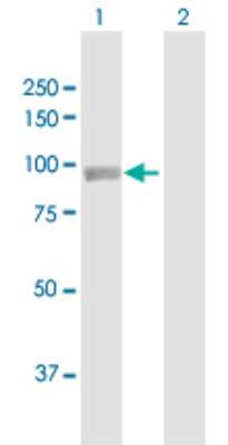Western Blot: PYGL Antibody [H00005836-D01P]