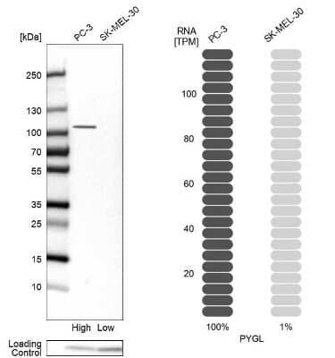 Western Blot: PYGL Antibody [NBP1-86147]