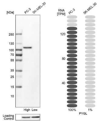 Western Blot: PYGL Antibody [NBP1-86182]