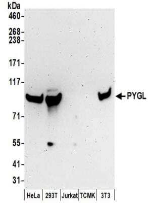 Western Blot: PYGL Antibody [NBP2-32246]