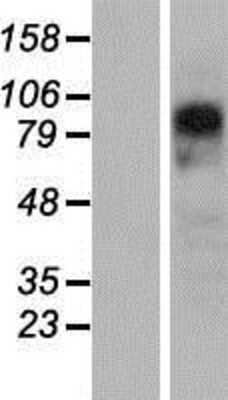 Western Blot: PYGL Overexpression Lysate [NBP2-08066]