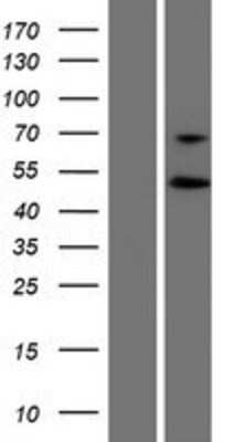 Western Blot: Pygopus-1 Overexpression Lysate [NBP2-07146]