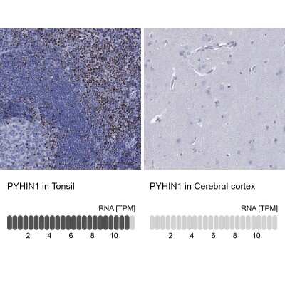 Immunocytochemistry/ Immunofluorescence: PYHIN1 Antibody [NBP3-17111]