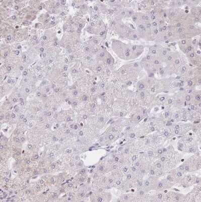 Immunohistochemistry-Paraffin: PYHIN1 Antibody [NBP2-13835]