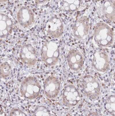 Immunohistochemistry-Paraffin: PYHIN1 Antibody [NBP2-13835]
