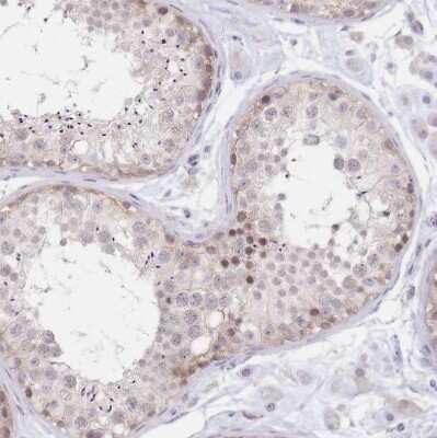 Immunohistochemistry-Paraffin: PYHIN1 Antibody [NBP2-13835]