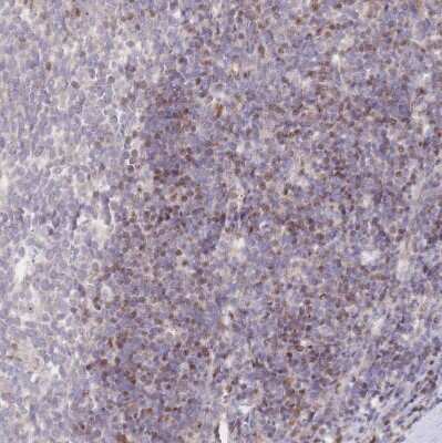 Immunohistochemistry-Paraffin: PYHIN1 Antibody [NBP2-13835]