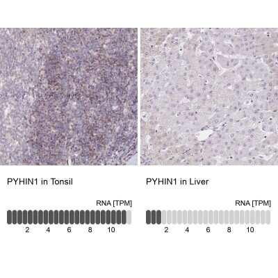 Immunohistochemistry-Paraffin: PYHIN1 Antibody [NBP2-13835]