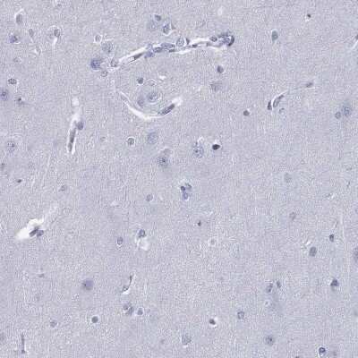 Immunohistochemistry-Paraffin: PYHIN1 Antibody [NBP3-17111]