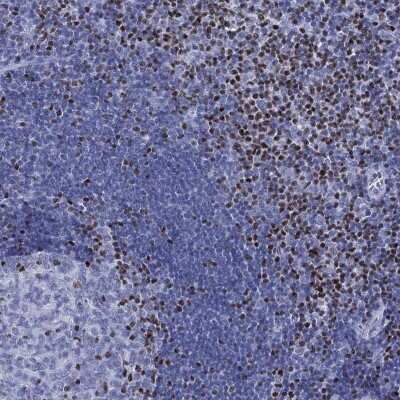Immunohistochemistry-Paraffin: PYHIN1 Antibody [NBP3-17111]