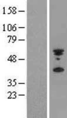 Western Blot: PYHIN1 Overexpression Lysate [NBL1-15023]