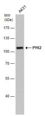 Western Blot: PYK2/FAK2 Antibody (GT1132) [NBP3-13573]