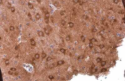 Immunohistochemistry-Paraffin: PYK2/FAK2 Antibody (GT858) [NBP3-13592]