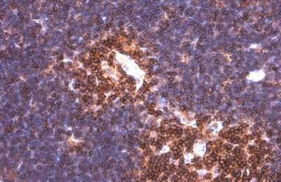 Immunohistochemistry-Paraffin: PYK2/FAK2 Antibody (GT858) [NBP3-13592]