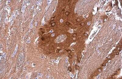Immunohistochemistry-Paraffin: PYK2/FAK2 Antibody (GT858) [NBP3-13592]