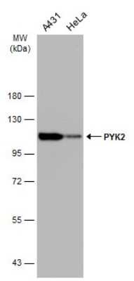 Western Blot: PYK2/FAK2 Antibody (GT858) [NBP3-13592]