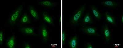 Immunocytochemistry/ Immunofluorescence: PYK2/FAK2 Antibody [NBP3-12969]