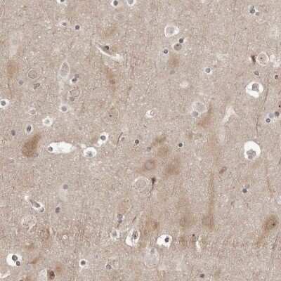 Immunohistochemistry-Paraffin: PYK2/FAK2 Antibody [NBP1-91227]