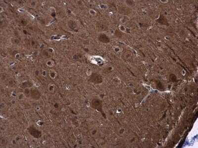 Immunohistochemistry-Paraffin: PYK2/FAK2 Antibody [NBP3-12969]
