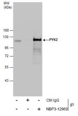 Immunoprecipitation: PYK2/FAK2 Antibody [NBP3-12969]