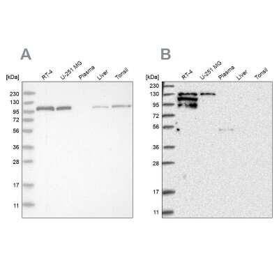 Western Blot: PYK2/FAK2 Antibody [NBP1-91227]